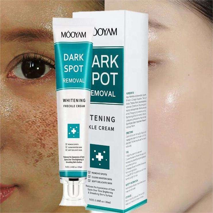 MOOYAM Whitening Dark Spot Removal Cream 30g