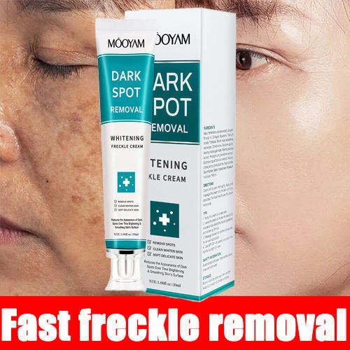 MOOYAM Whitening Dark Spot Removal Cream 30g