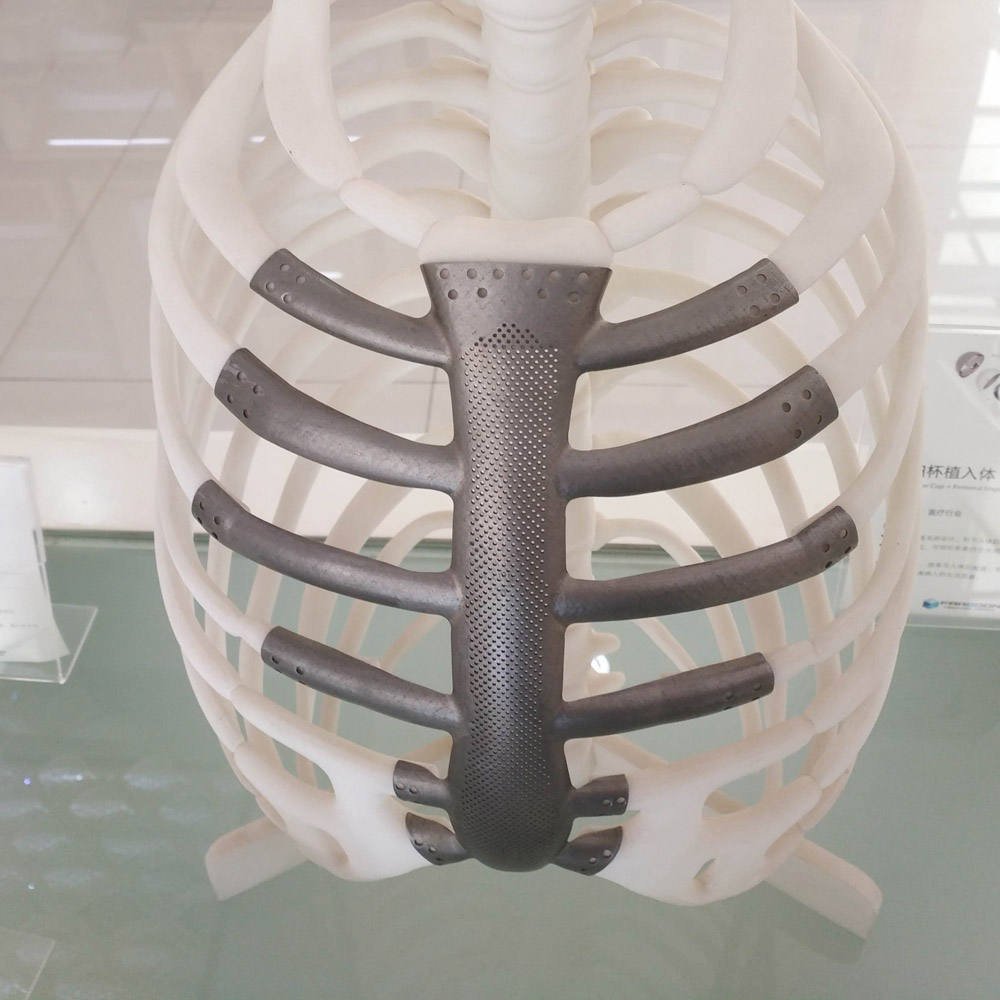 3D Print with Metal | Leading Metal 3D Printer | Metal 3D Printing