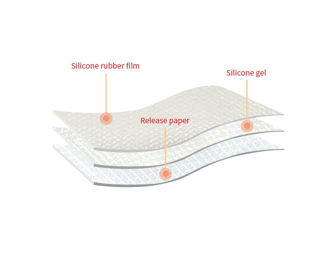 Hot Sale Body Application Silicone Gel Scar Removal Patch Economic Chinese Plaster for Scar Removal