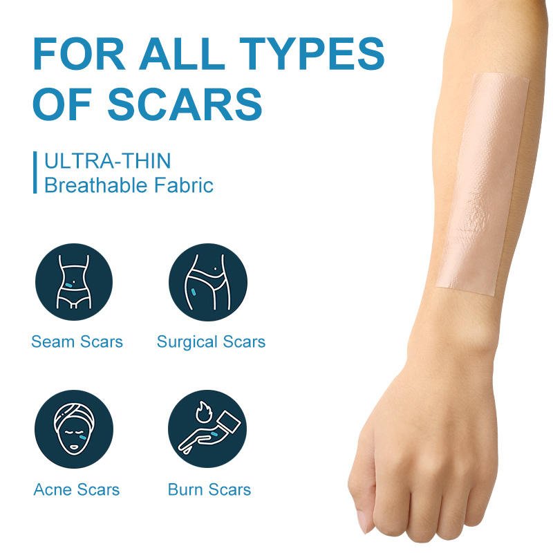 High Quality Reusable Silicone Scar Therapy Gel Tape Competitive Price Removal Patch for Acne Scar Rehabilitation Therapy