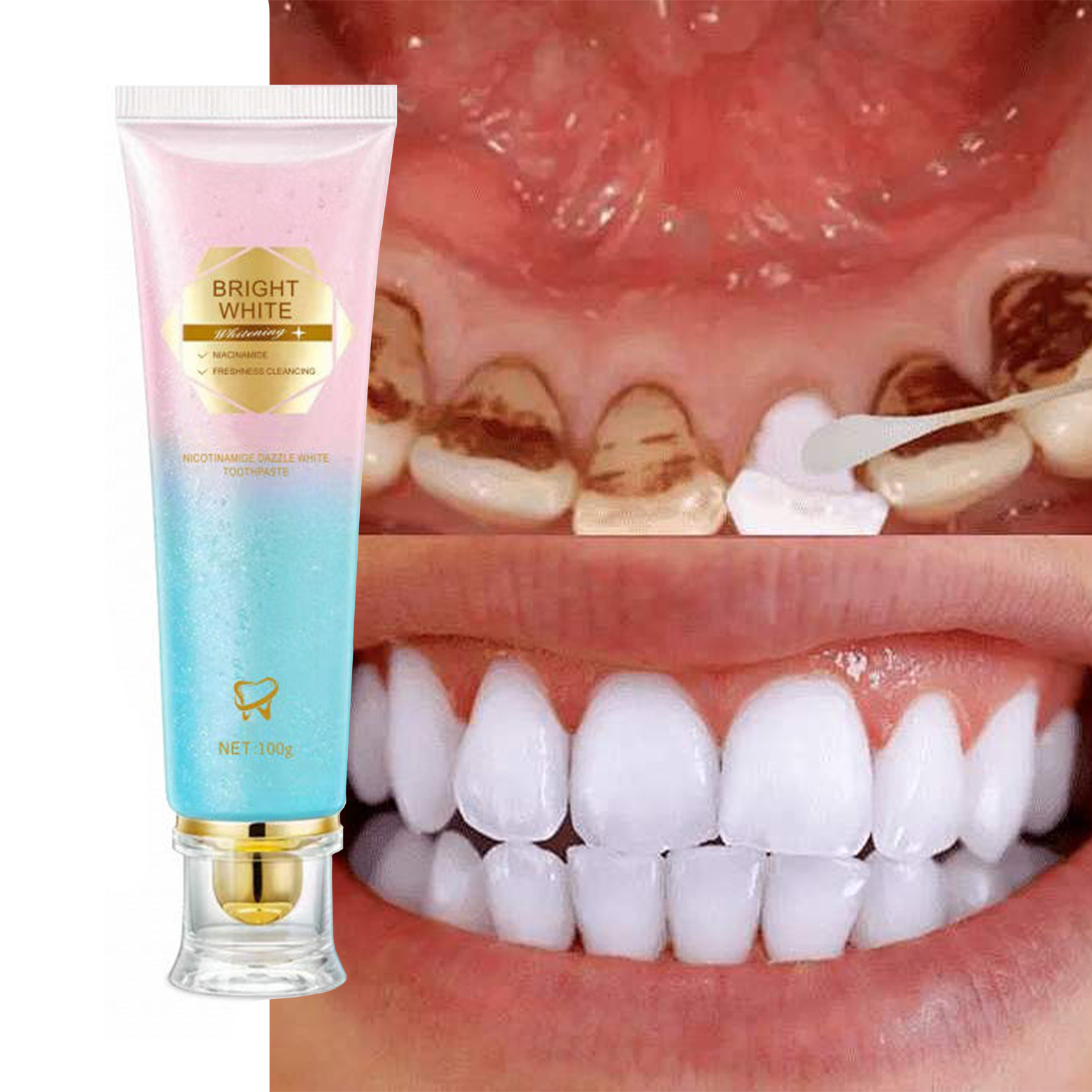 Adult Toothpaste Care Teeth Whitening Toothpaste 100g with Niacinamide for Stain Removal for Adults Use at Home